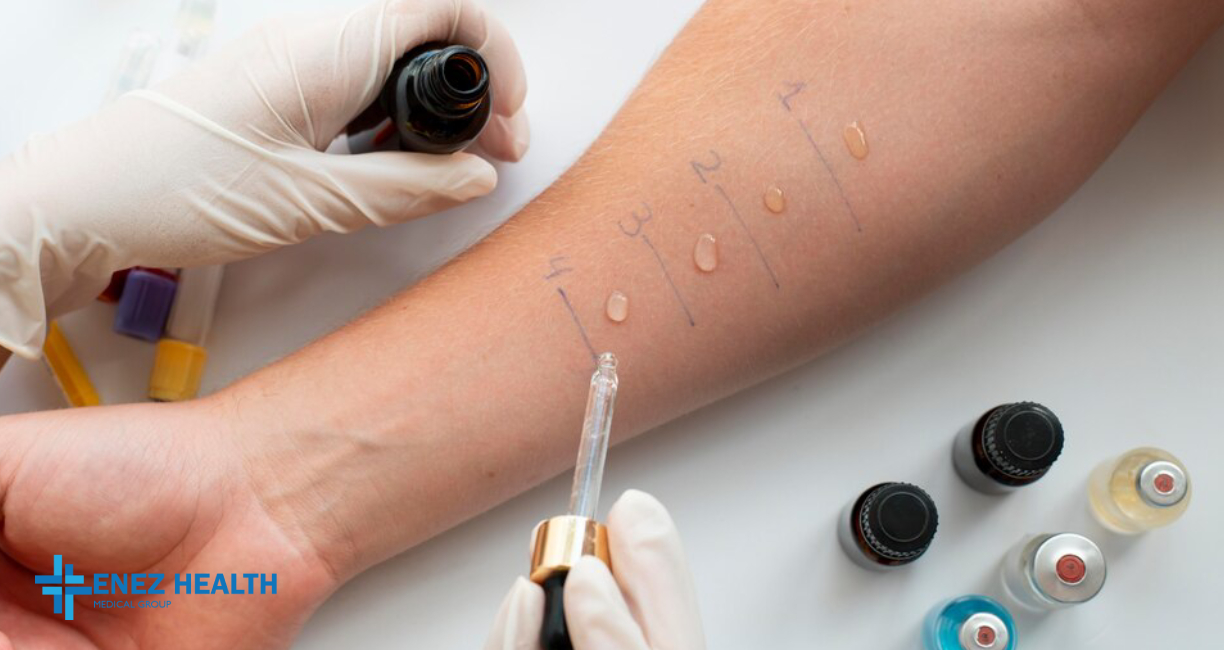 Allergic Diseases